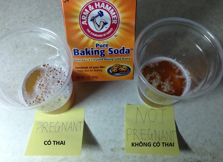 Ket-qua-thuc-hien-thu-thai-bang-baking-soda